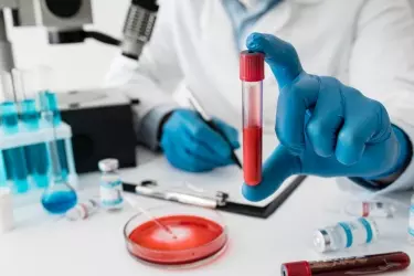 best pathology lab in bhagalpur, best lab for blood test in bhagalpur, best nabl lab in bhagalpur